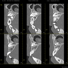 Scanner Cone Beam coupe canine